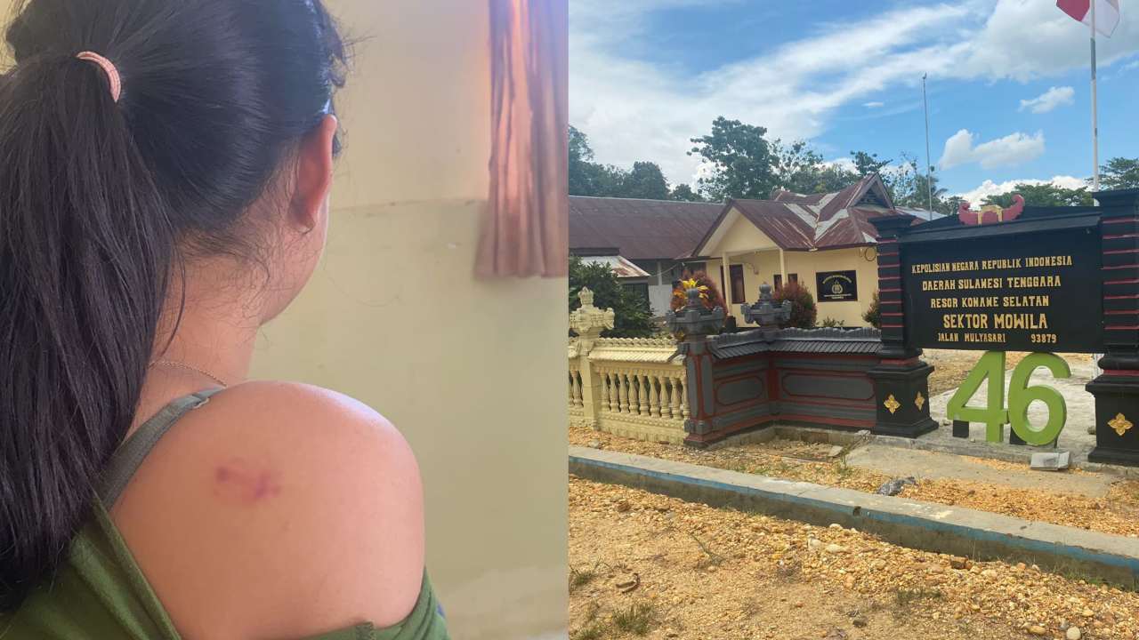 Siswi SMP di Konawe Selatan Diduga Jadi Korban Penganiayaan