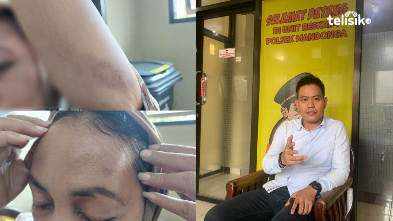 Wanita di Kendari Ini Kerap Dianiaya Kekasih, Pelaku Mantan Anggota TNI