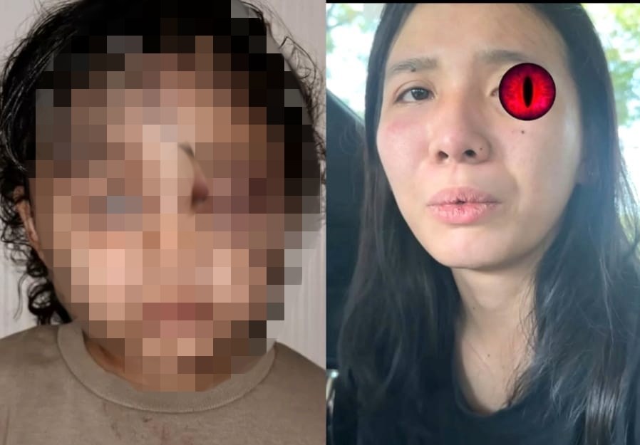 4 Fakta Baru Pengasuh Aniaya Anak Aghnia Punjabi, Trauma Berat hingga Pelaku Diperiksa Kejiwaan