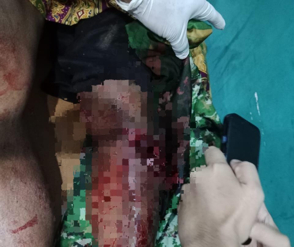 Diterkam saat Mandi di Sungai, Warga Muna Barat Tarung Melawan Buaya