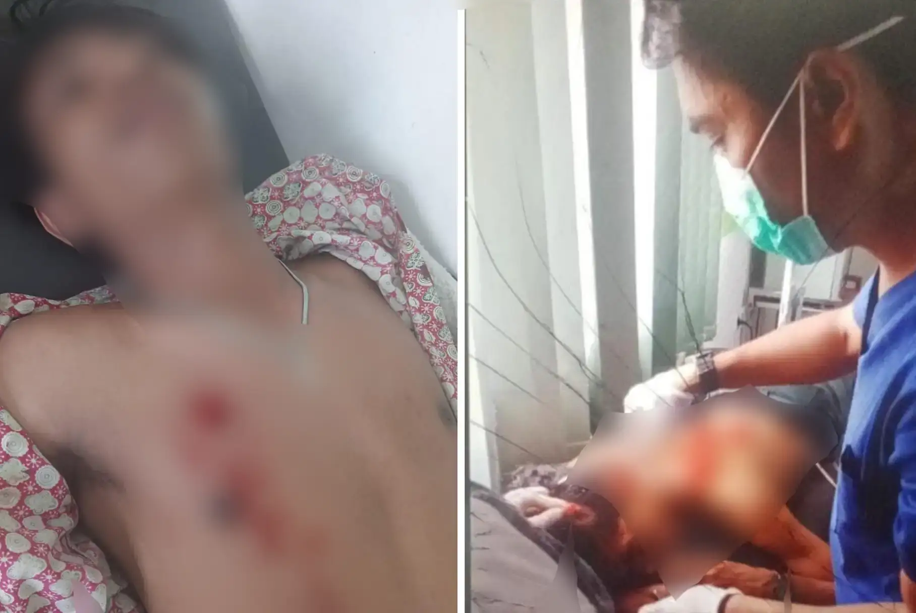 Nonton Bareng Perkelahian, Dua Pelajar SMA di Muna Malah Ditikam