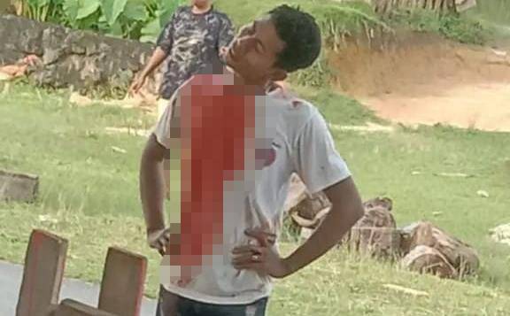 Pelaku Pembacokan di Muna Barat Belum Ditangkap, Saksi Beberkan Kronologi Kejadian