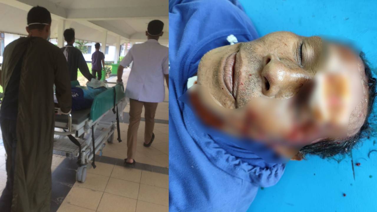 Seorang Pria di Kota Kendari Kritis Usai Alami Kecelakaan, Diduga Tabrak Mobil