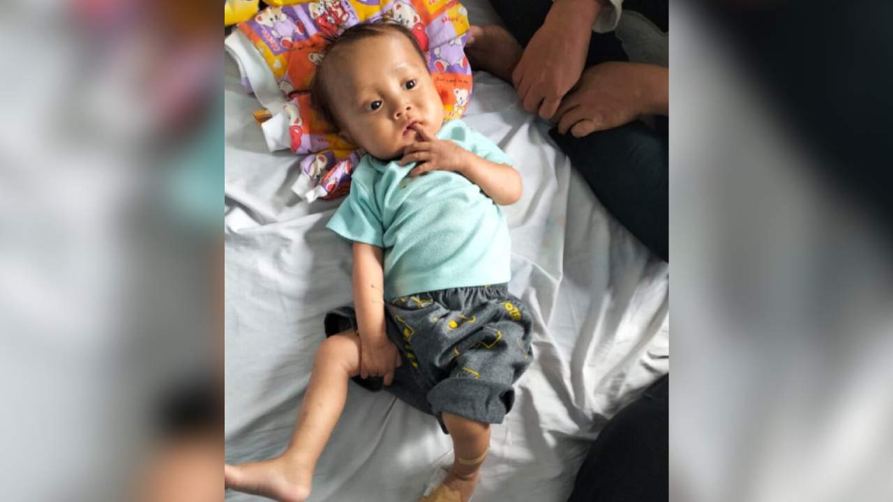 Bayi di Buton Derita Gizi Buruk dan Butuh Bantuan Biaya Pengobatan