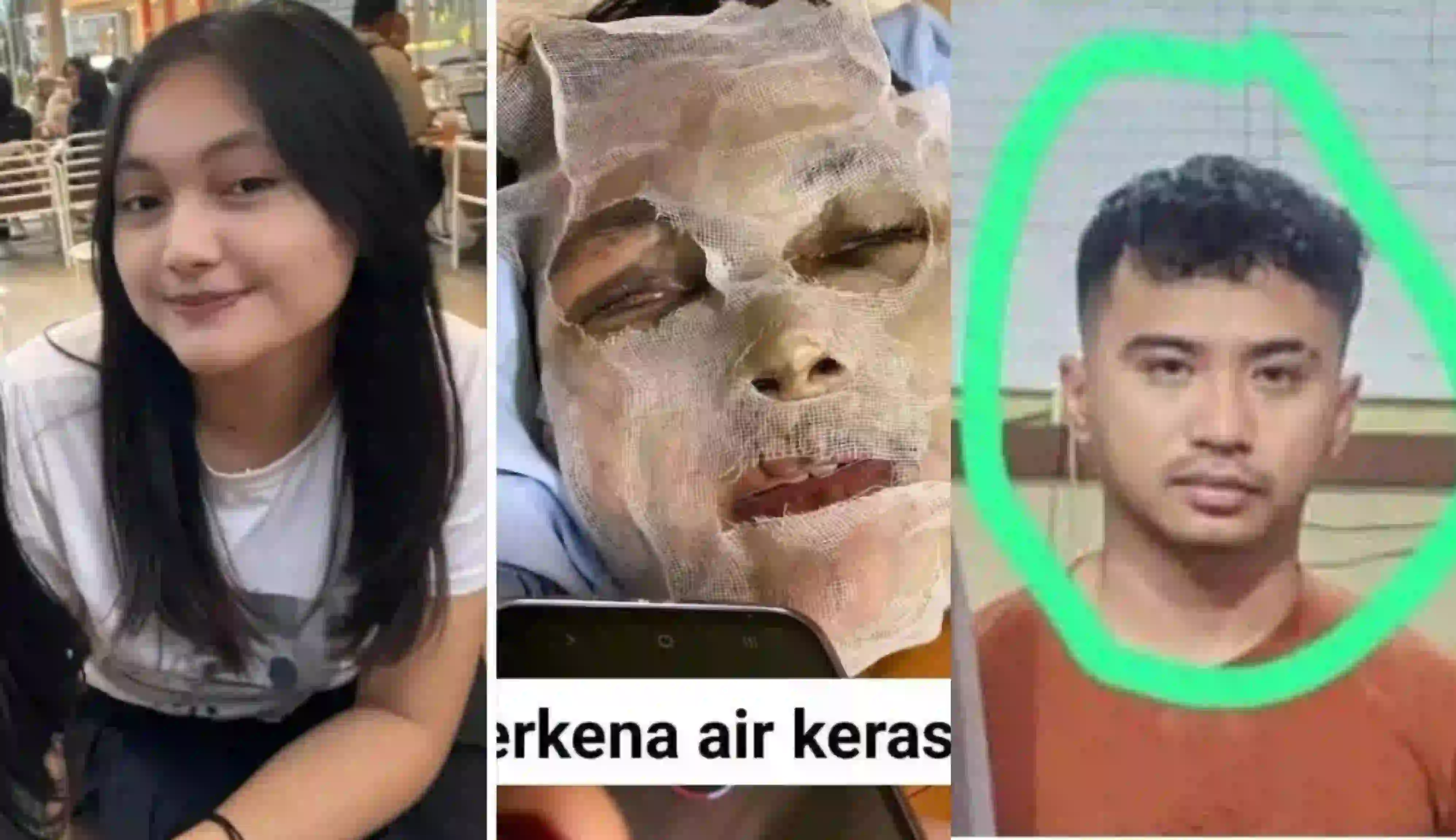 Sosok Belly Villsen: Mahasiswa S2 Hukum Otaki Penyiraman Air Keras ke Mantan Pacar Natasya Hutagalung