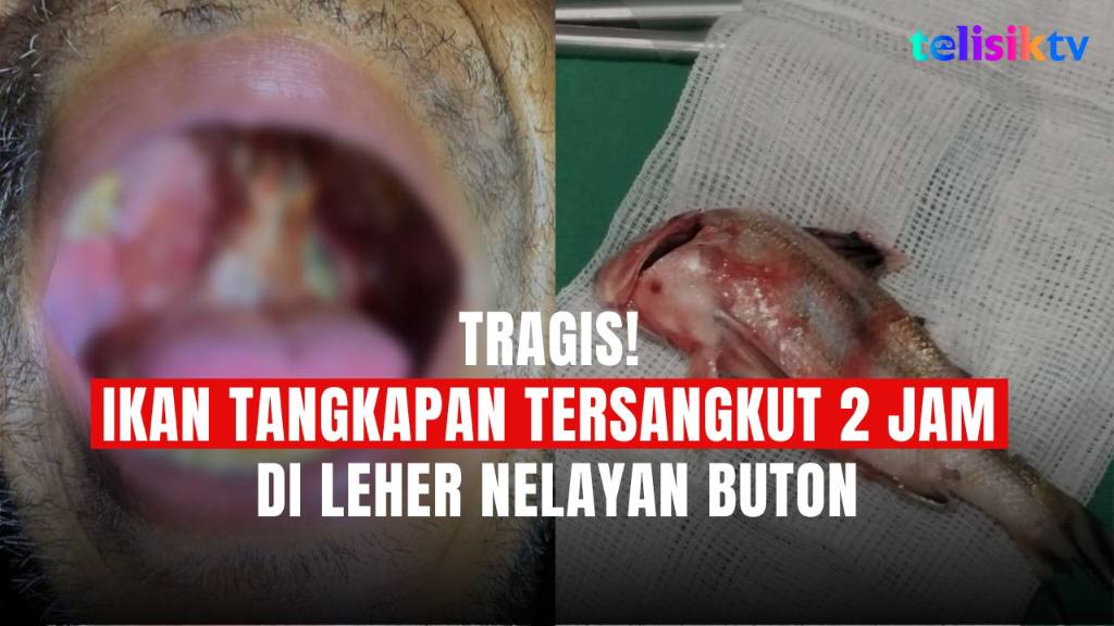TELISIKTV: Tragis, Ikan Tangkapan Tersangkut 2 Jam di Leher Nelayan Buton
