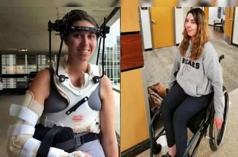 Ajaib, Kepala Wanita Terputus di Dalam tapi Berhasil Disambung Kembali