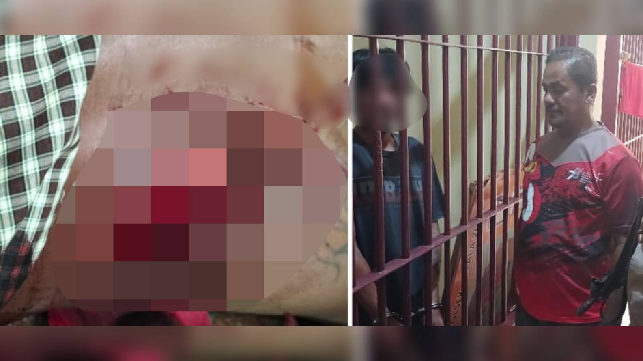 Warga Loka Kolaka Utara Kritis usai Ditebas Parang, Sekujur Tubuh Dipenuhi Luka Sayatan