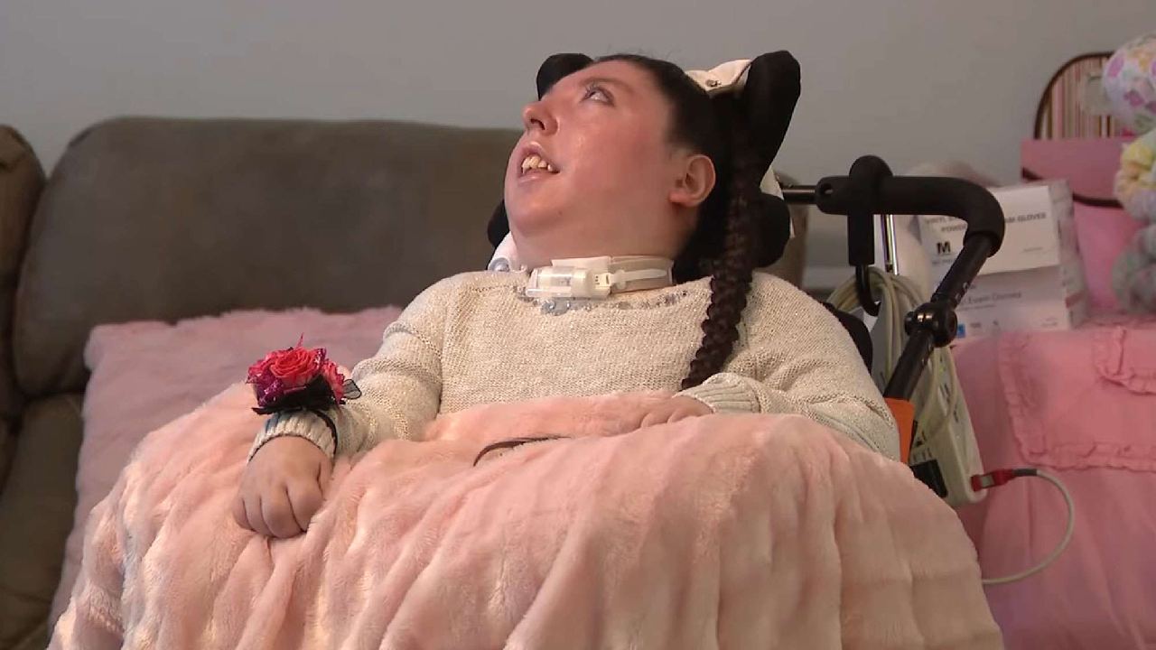 Unik: Dokter Prediksi Hanya Bertahan 4 Tahun, Wanita AS Lahir Tanpa Otak Rayakan Ulang Tahun ke-20