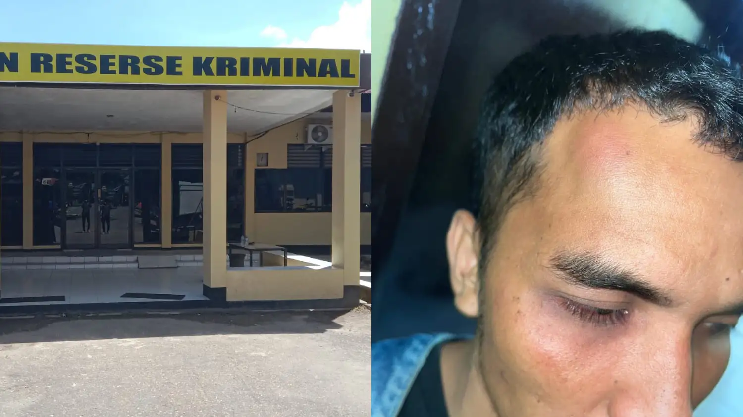 Pria Babak Belur Usai Dikeroyok di Billiard Prawira Kendari, Proses Hukum Dinilai Mandek dan Keluarga Lapor Wassidik