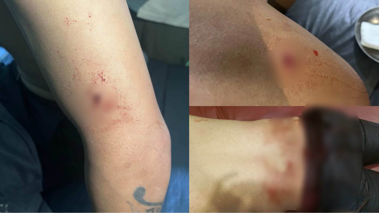 Sekuriti Ngamuk Aniaya dan Tikam Tiga Karyawan Rich Club Kendari