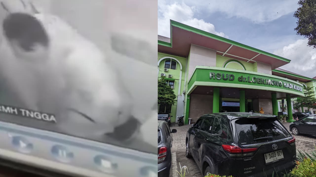 Viral Link Video Syur CCTV 50 Detik 2 Nakes di RSUD, Begini Penjelasannya