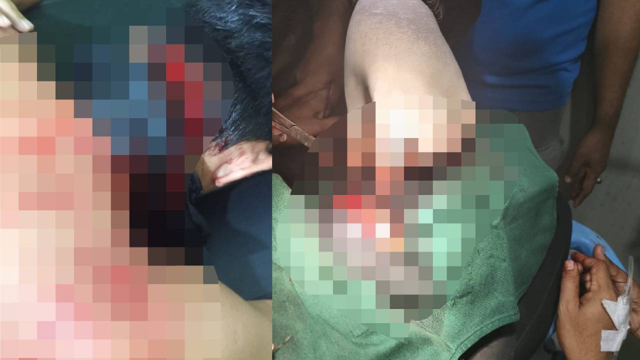 Pria di Gunung Jati Kendari Dibacok hingga Leher Nyaris Putus