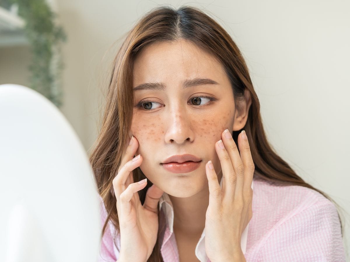 Rekomendasi Sunscreen Bantu Samarkan Flek Hitam, Ada yang Rp 50 Ribuan