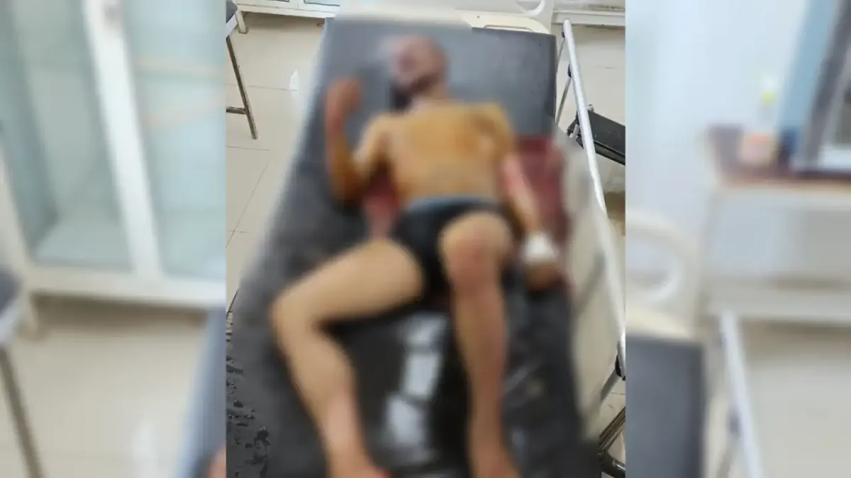 Diduga Alami Gangguan Jiwa, Pemuda di Muna Nekat Bakar Diri di Kamarnya